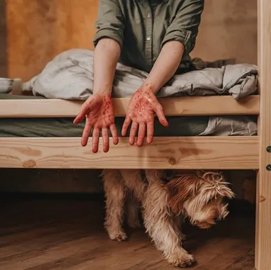 Unlock 12 reasons not to own a Goldendoodle: 15 Goldendoodle-allergies
